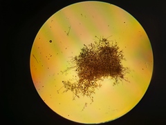 Peronospora chenopodii