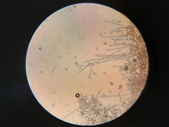 Peronospora chenopodii