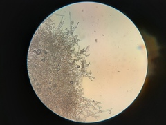 Peronospora chenopodii