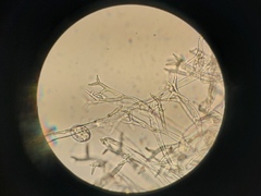 Peronospora chenopodii