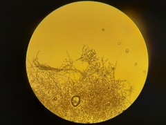 Peronospora chenopodii