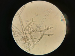 Peronospora chenopodii