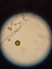 Protozoa