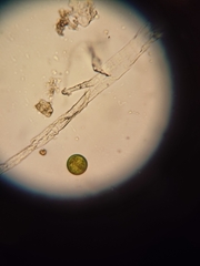 Protozoa