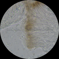 Lecanora pseudistera