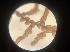 Frullania kunzei
