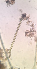Triploceras gracile