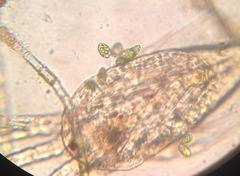 Colacium vesiculosum