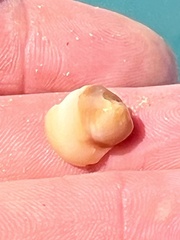 Neverita duplicata