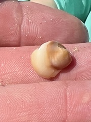Neverita duplicata
