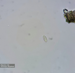 Cyclidium