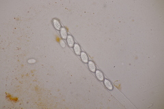 Melastiza cornubiensis