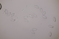 Melastiza cornubiensis