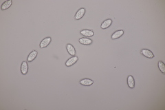 Melastiza cornubiensis