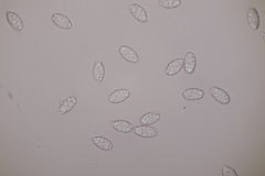 Melastiza cornubiensis