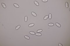 Melastiza cornubiensis