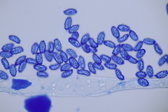 Melastiza cornubiensis