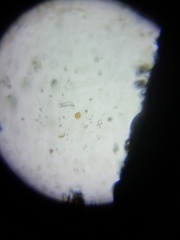 Amoebozoa