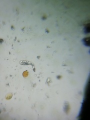 Amoebozoa