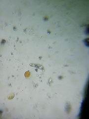 Amoebozoa