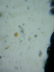 Amoebozoa