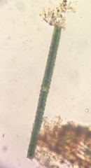 Pleurotaenium verrucosum