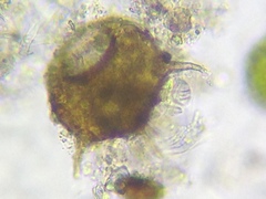 Centropyxis discoides