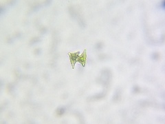 Staurastrum anatinum