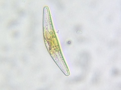 Cymbella