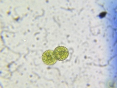 Cosmarium