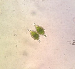 Staurastrum petsamoense