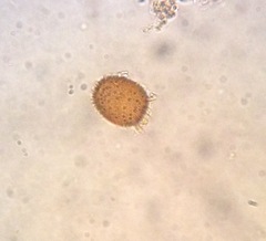 Trachelomonas armata