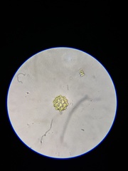 Coelastrum pulchrum