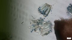 Sclerococcum stygium