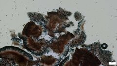 Sclerococcum stygium