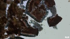 Sclerococcum stygium