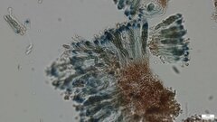 Sclerococcum stygium