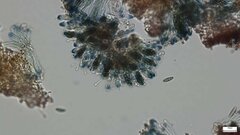 Sclerococcum stygium