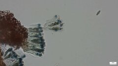 Sclerococcum stygium