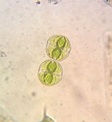 Staurastrum orbiculare