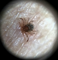 Amblyomma cajennense