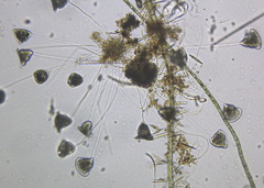 Vorticella