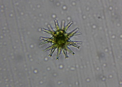 Staurastrum arctiscon