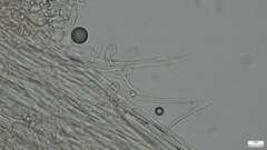 Cystolepiota