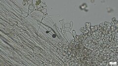Cystolepiota