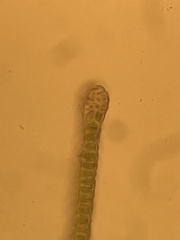 Fissidens ventricosus