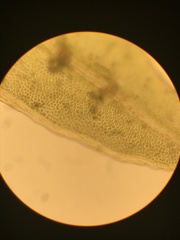 Fissidens ventricosus