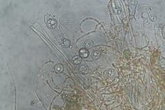 Pulvinula tetraspora