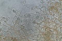 Pulvinula tetraspora