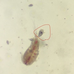 Protozoa